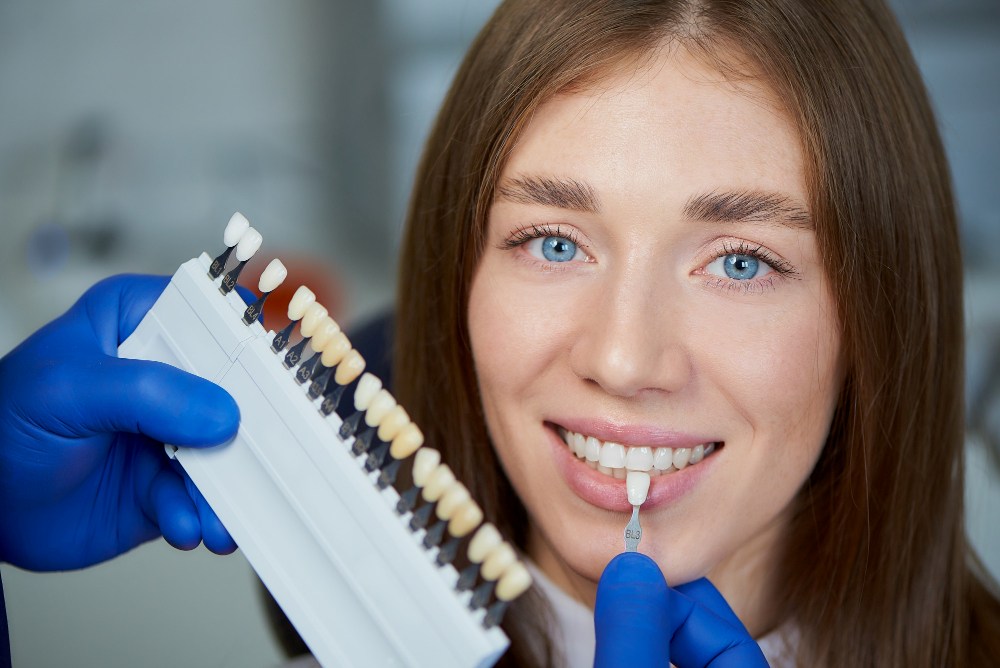 emax veneers costs