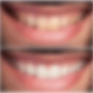 blur-implant-gorsel